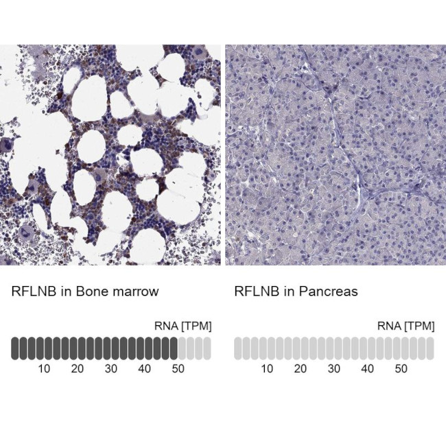 FAM101B Antibody