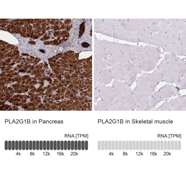 PLA2 Antibody