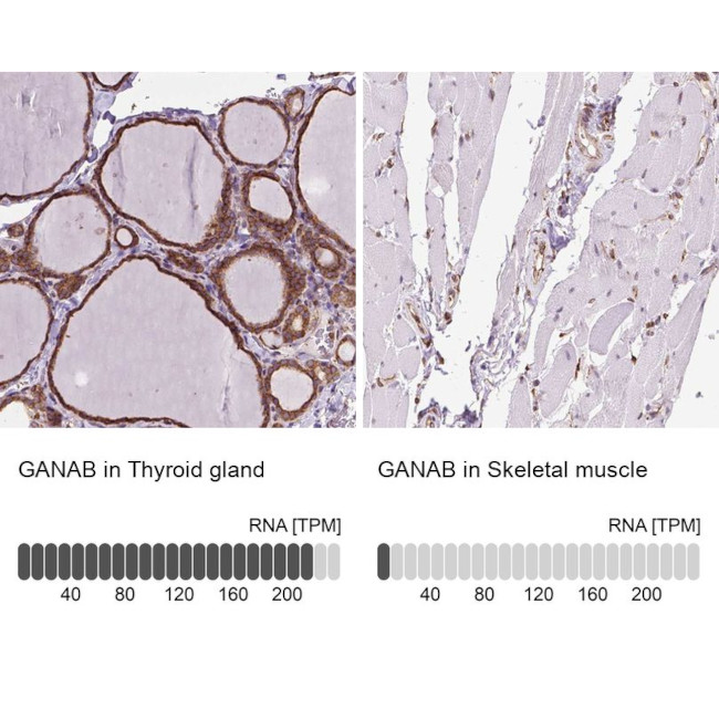 GANAB Antibody