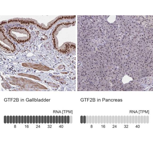 GTF2B Antibody