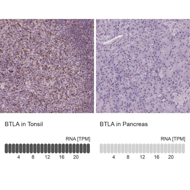 BTLA Antibody