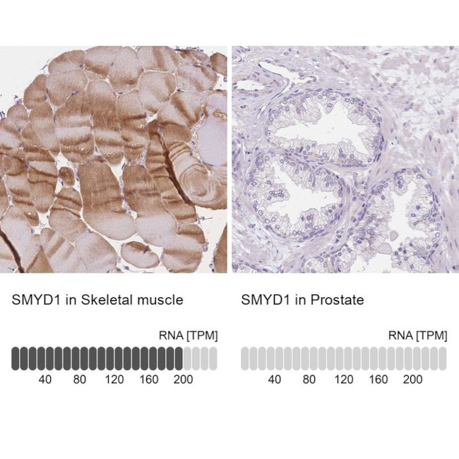 SMYD1 Antibody