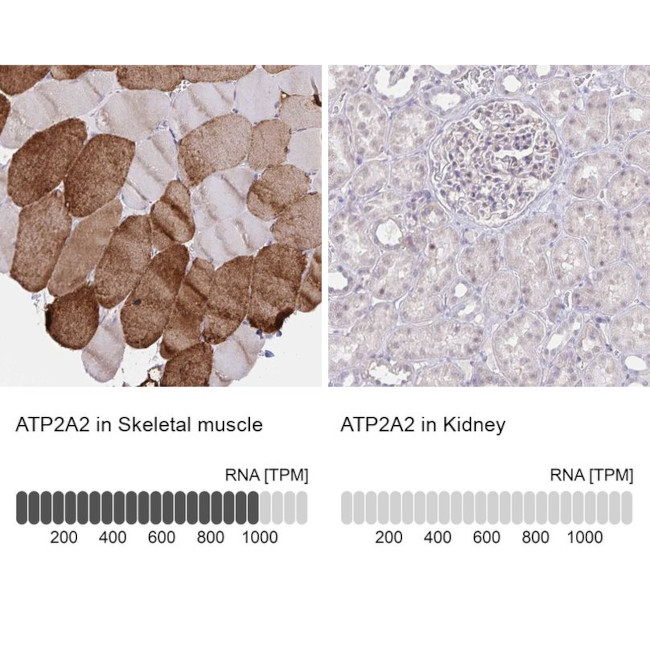 SERCA2 ATPase Antibody