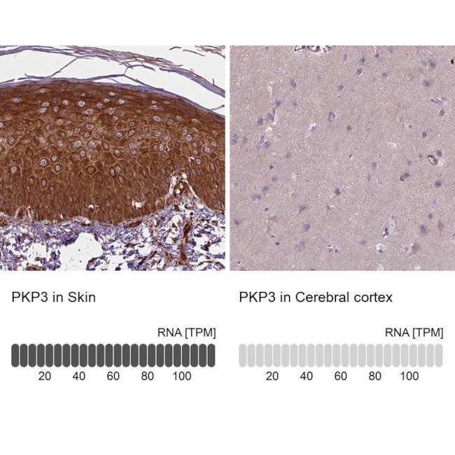 PKP3 Antibody