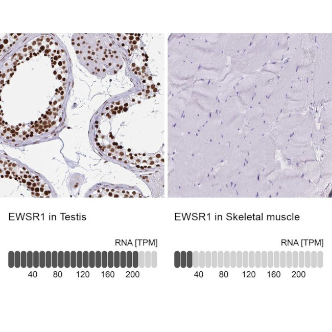 EWSR1 Antibody