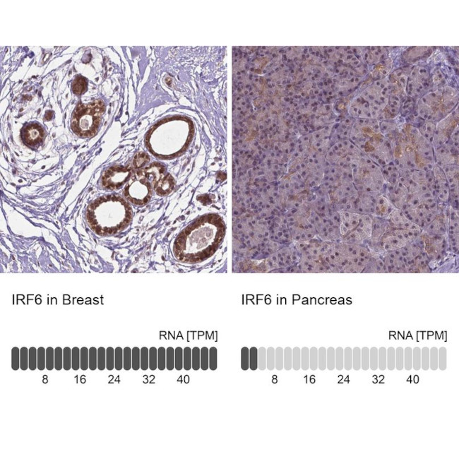 IRF6 Antibody