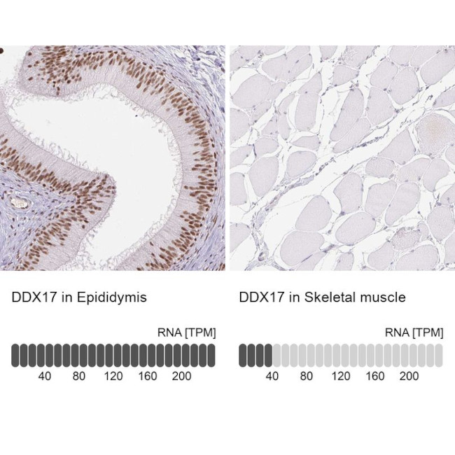 DDX17 Antibody