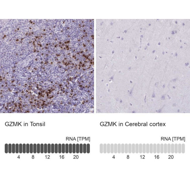 Granzyme K Antibody