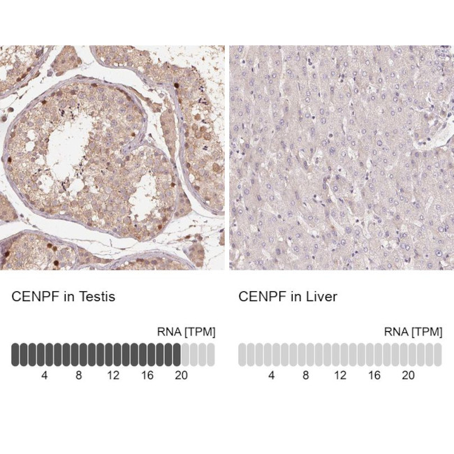 CENPF Antibody