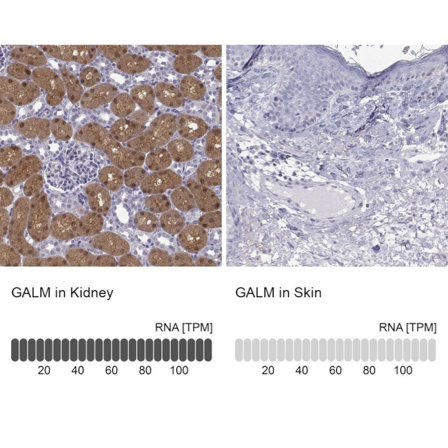 GALM Antibody