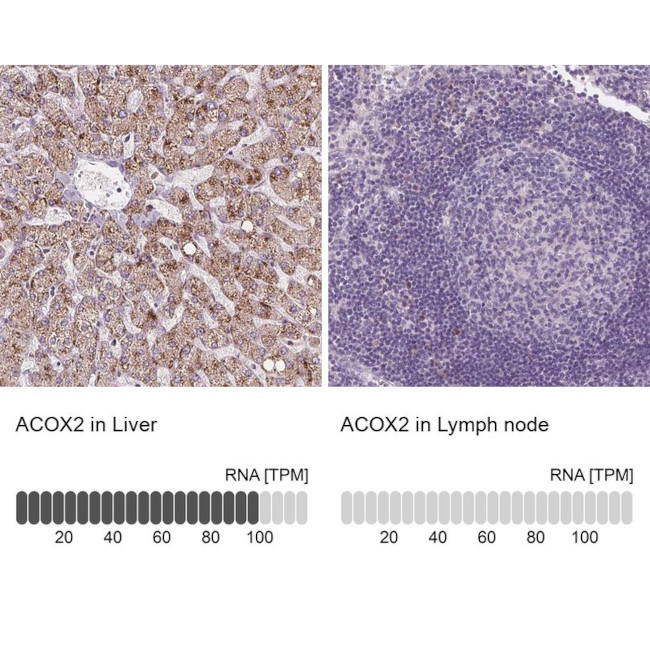 ACOX2 Antibody