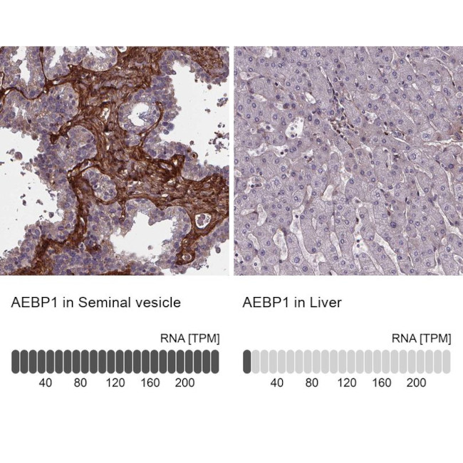 AEBP1 Antibody