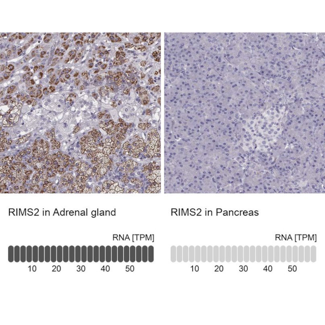 RIM2 Antibody