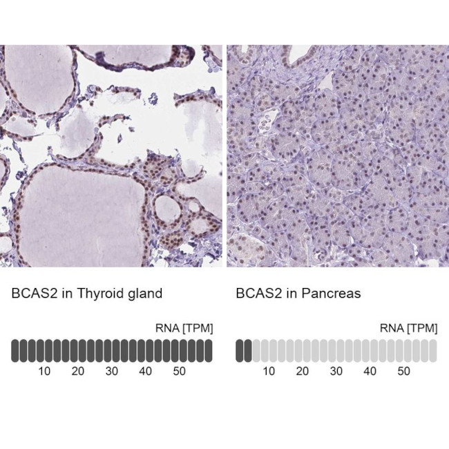 BCAS2 Antibody