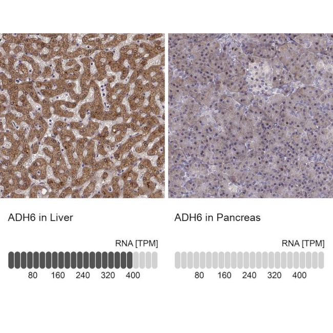 ADH6 Antibody