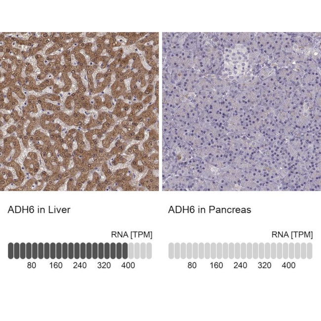 ADH6 Antibody