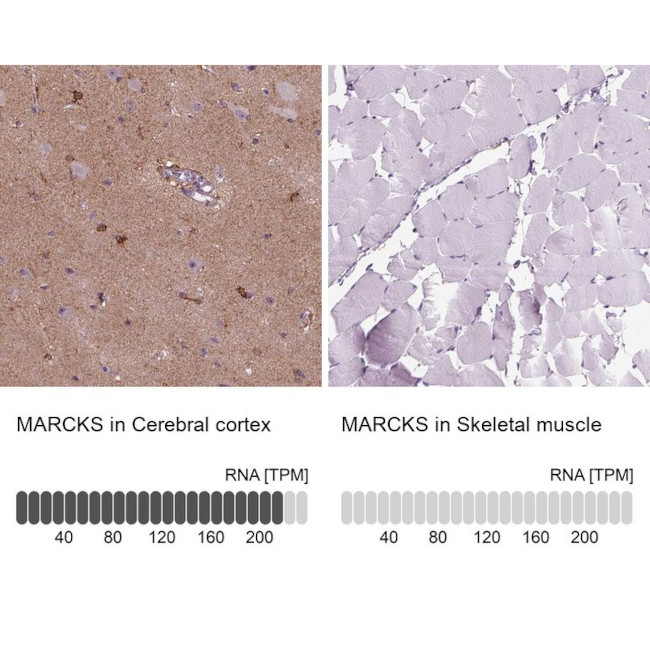 MARCKS Antibody