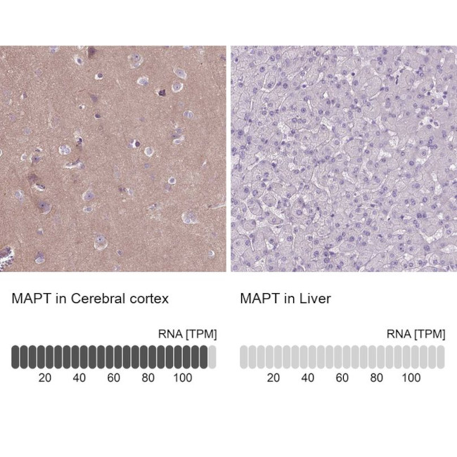 Tau Antibody