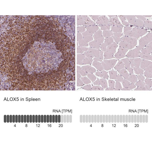 ALOX5 Antibody