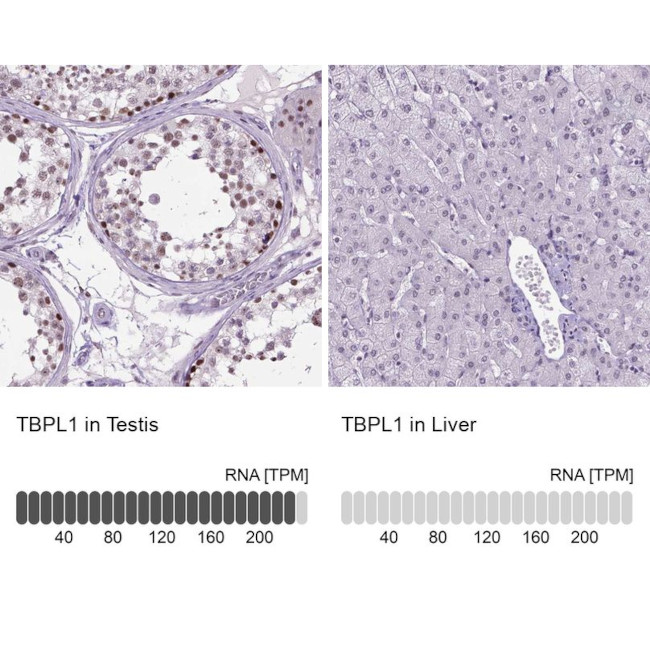 TBPL1 Antibody