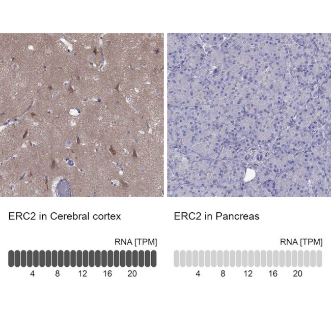 Erc2 Antibody