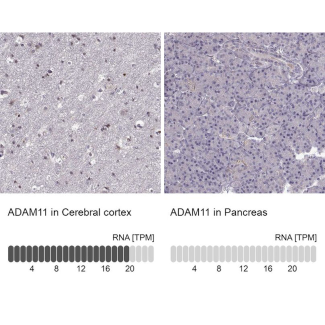 ADAM11 Antibody