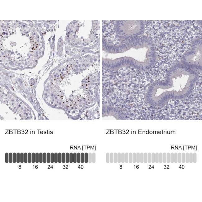 TZFP Antibody