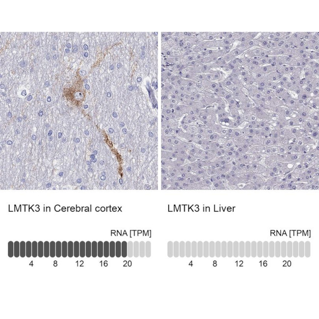 LMTK3 Antibody