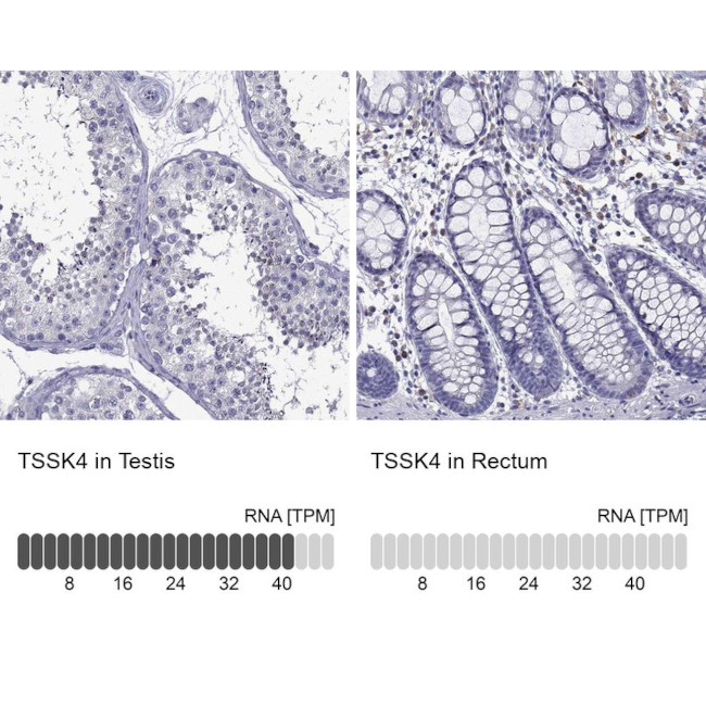 TSSK4 Antibody