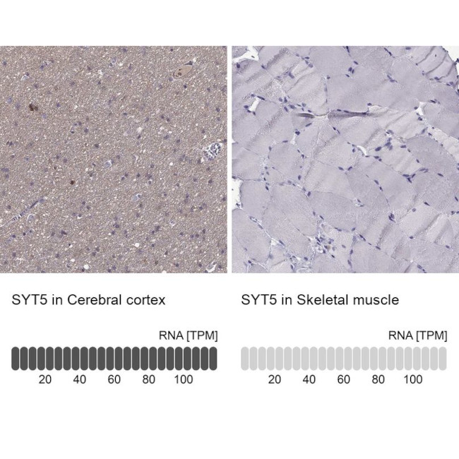 Synaptotagmin 5 Antibody