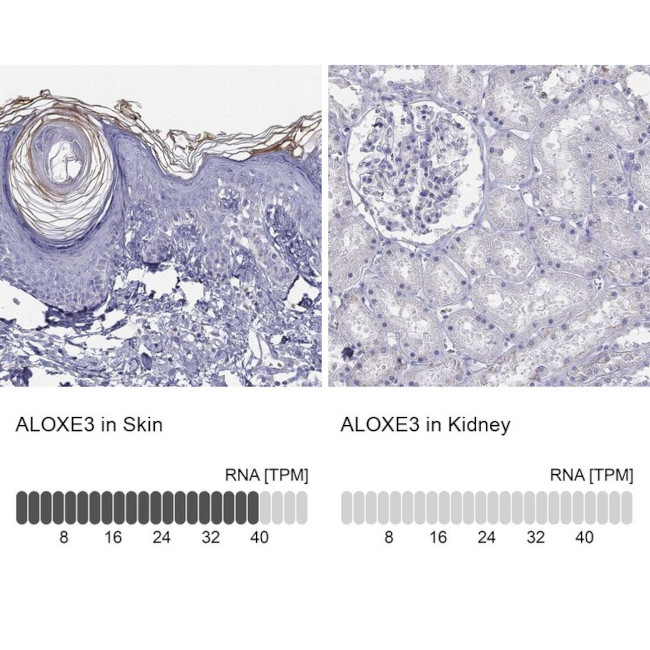 ALOXE3 Antibody