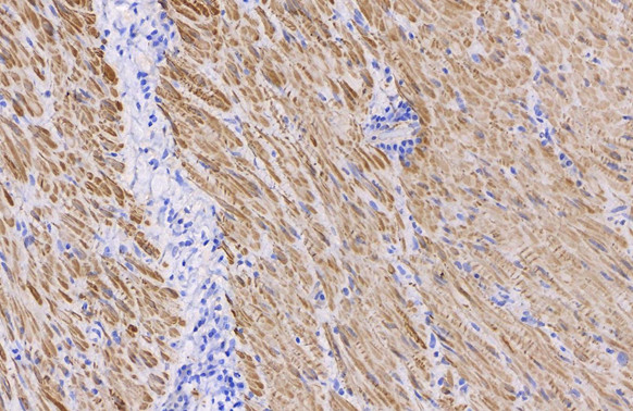 Alpha-Smooth Muscle Actin Antibody in Immunohistochemistry (Paraffin) (IHC (P))