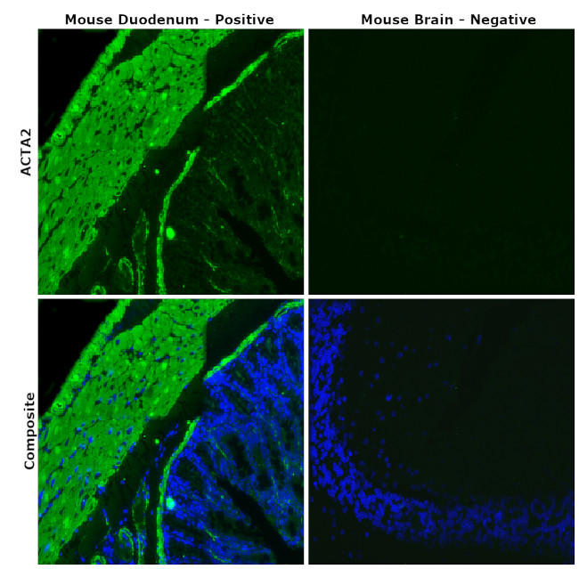 Alpha-Smooth Muscle Actin Antibody in Immunohistochemistry (Paraffin) (IHC (P))