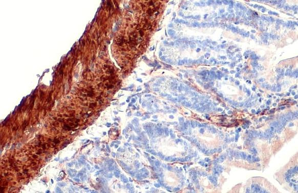 Alpha-Smooth Muscle Actin Antibody in Immunohistochemistry (Paraffin) (IHC (P))