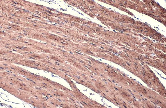 Alpha-Smooth Muscle Actin Antibody in Immunohistochemistry (Paraffin) (IHC (P))