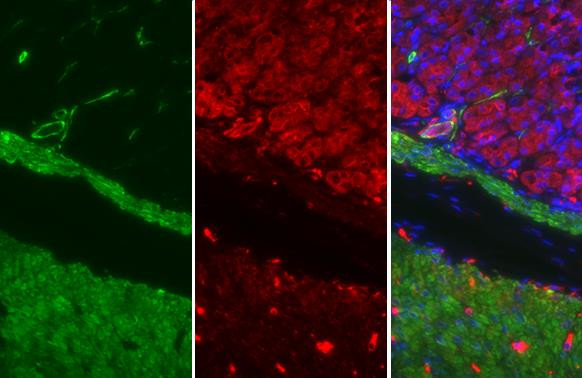 Alpha-Smooth Muscle Actin Antibody in Immunohistochemistry (Paraffin) (IHC (P))