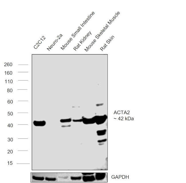 Alpha-Smooth Muscle Actin Antibody