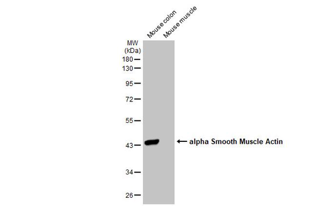 Alpha-Smooth Muscle Actin Antibody in Western Blot (WB)