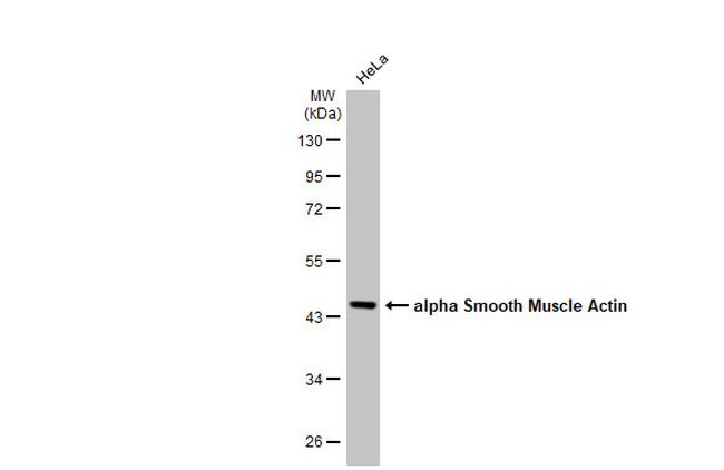 Alpha-Smooth Muscle Actin Antibody in Western Blot (WB)