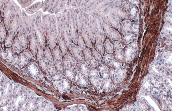 Alpha-Smooth Muscle Actin Antibody in Immunohistochemistry (Paraffin) (IHC (P))