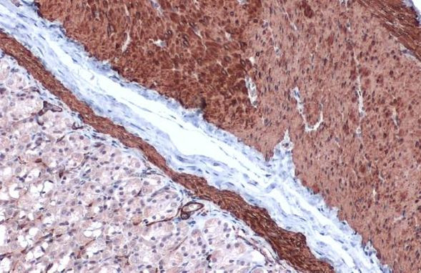 Alpha-Smooth Muscle Actin Antibody in Immunohistochemistry (Paraffin) (IHC (P))