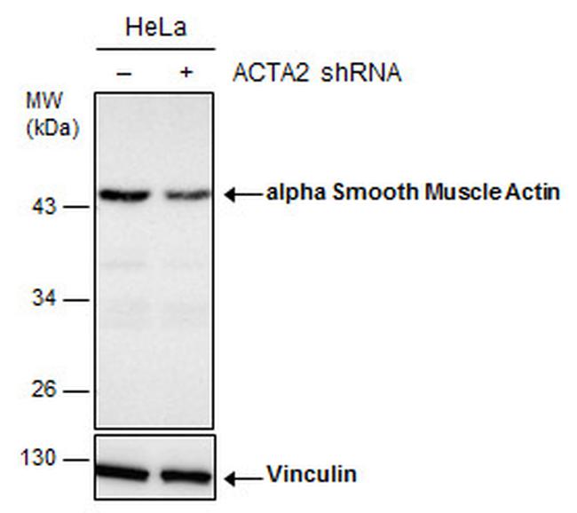 Alpha-Smooth Muscle Actin Antibody in Western Blot (WB)