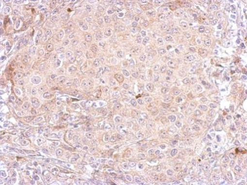 PSA Antibody in Immunohistochemistry (Paraffin) (IHC (P))