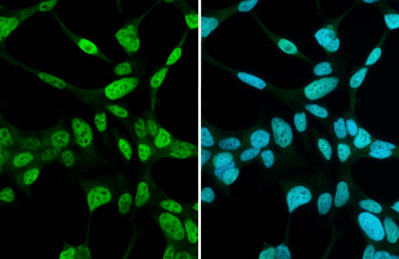 Androgen Receptor Antibody in Immunocytochemistry (ICC/IF)