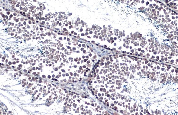 Androgen Receptor Antibody in Immunohistochemistry (Paraffin) (IHC (P))