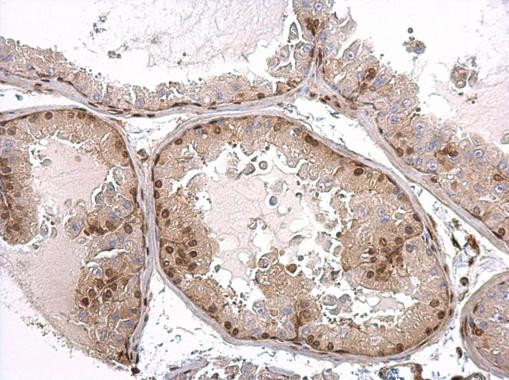 Androgen Receptor Antibody in Immunohistochemistry (Paraffin) (IHC (P))