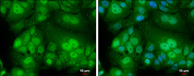 Androgen Receptor Antibody in Immunocytochemistry (ICC/IF)