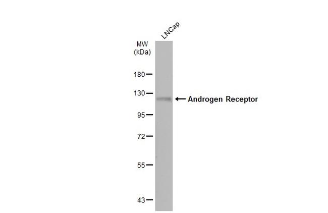 Androgen Receptor Antibody in Western Blot (WB)