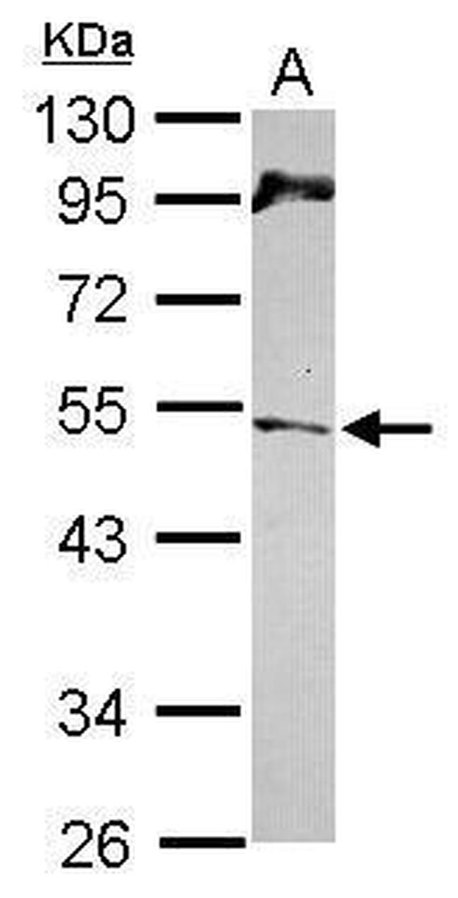 Chk1 Antibody in Western Blot (WB)