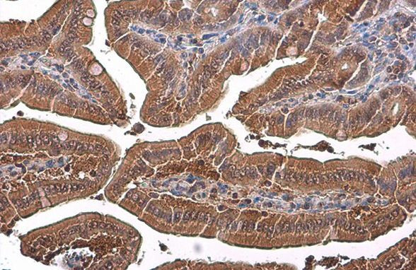 GAPDH Antibody in Immunohistochemistry (Paraffin) (IHC (P))